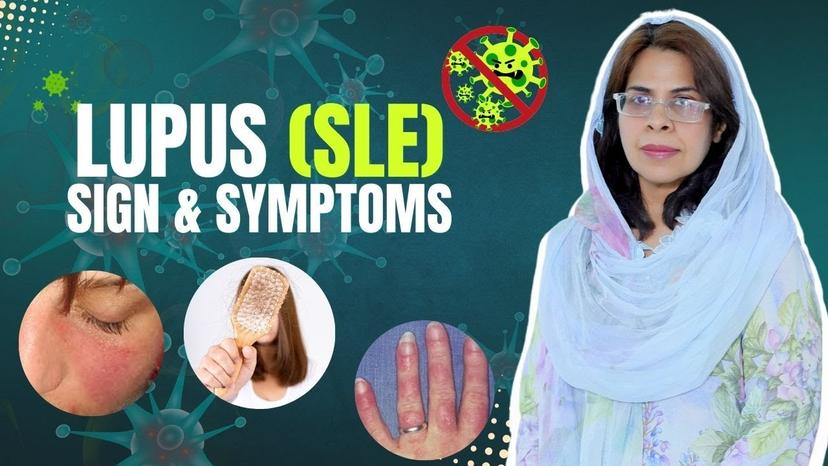 SLE Lumpus Symptoms