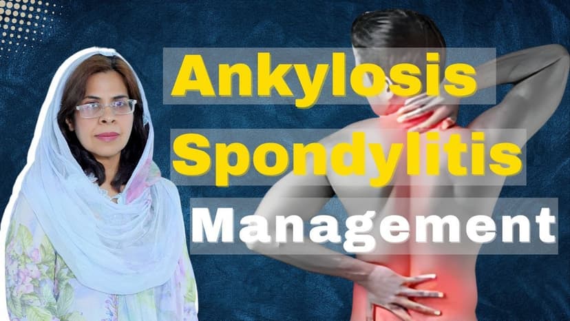 Managing Ankylosing Spondylitis