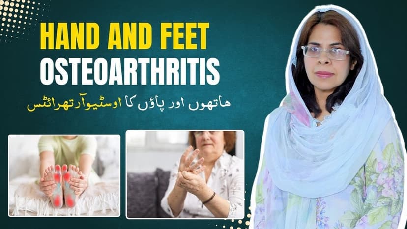 Hand & Foot Osteoarthritis
