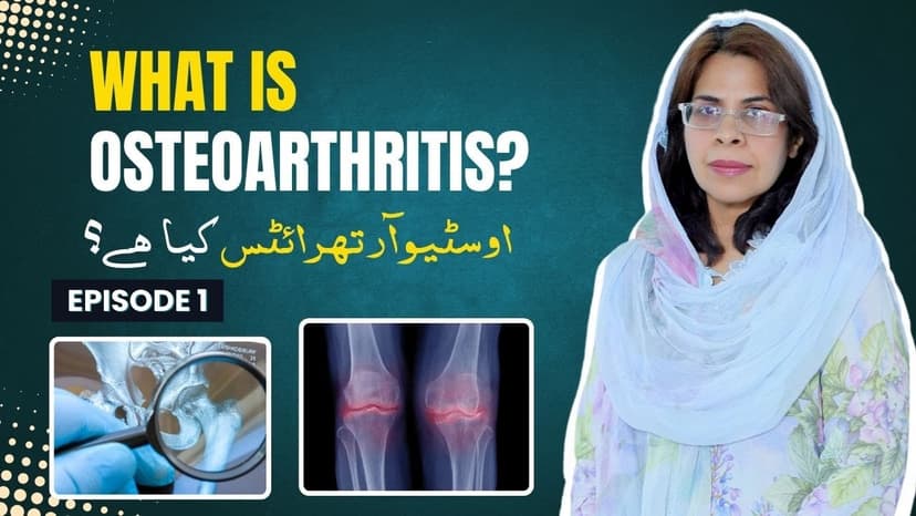 What Is Osteoarthritis?