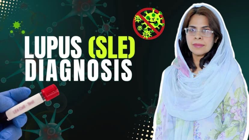 Diagnosis of SLE Lumpus